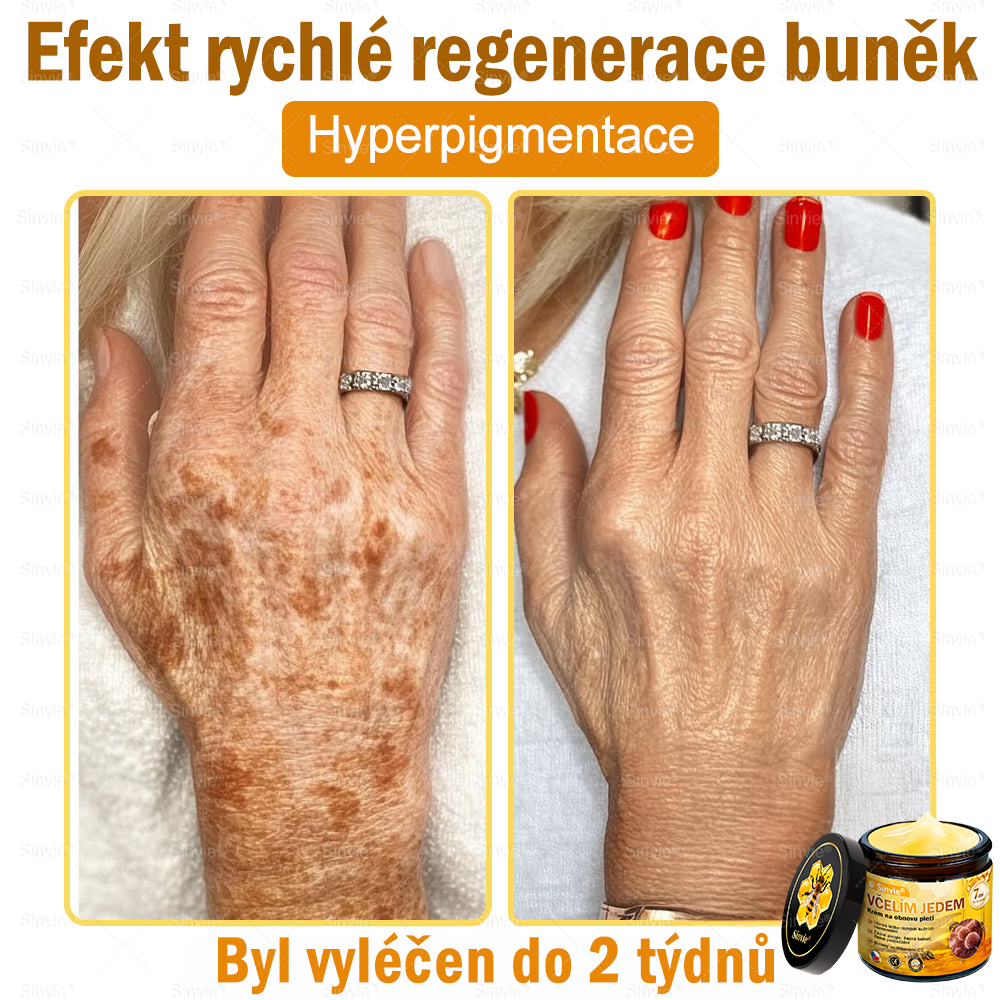 ⚡Sinvie® Krém na obnovu pleti s včelím jedem | 50 ml | Doporučeno Českou dermatovenerologickou společností