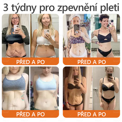 ⚡Sinvie® Krém na obnovu pleti s včelím jedem | 50 ml | Doporučeno Českou dermatovenerologickou společností