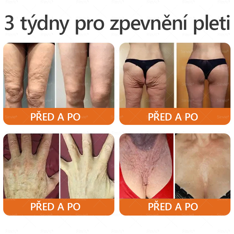 ⚡Sinvie® Krém na obnovu pleti s včelím jedem | 50 ml | Doporučeno Českou dermatovenerologickou společností