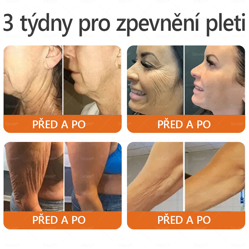 🌻 Sinvie® Krém na obnovu pleti s včelím jedem 🔥 Doporučeno dermatology | Proti vráskám, pigmentovým skvrnám a ochablé pleti - 50 ml