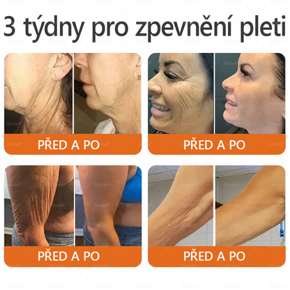 🌻 Sinvie® Krém na obnovu pleti s včelím jedem 🔥 Doporučeno dermatology | Proti vráskám, pigmentovým skvrnám a ochablé pleti - 50 ml