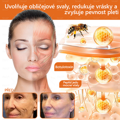 ⚡Sinvie® Krém na obnovu pleti s včelím jedem | 50 ml | Doporučeno Českou dermatovenerologickou společností