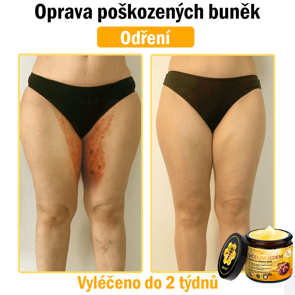 ⚡Sinvie® Krém na obnovu pleti s včelím jedem | 50 ml | Doporučeno Českou dermatovenerologickou společností