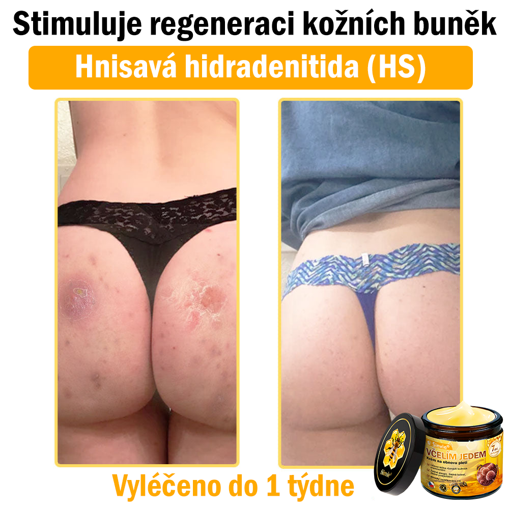 ⚡Sinvie® Krém na obnovu pleti s včelím jedem | 50 ml | Doporučeno Českou dermatovenerologickou společností