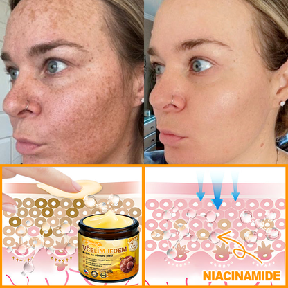 🌻 Sinvie® Krém na obnovu pleti s včelím jedem 🔥 Doporučeno dermatology | Proti vráskám, pigmentovým skvrnám a ochablé pleti - 50 ml