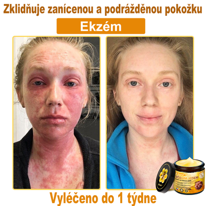 ⚡Sinvie® Krém na obnovu pleti s včelím jedem | 50 ml | Doporučeno Českou dermatovenerologickou společností