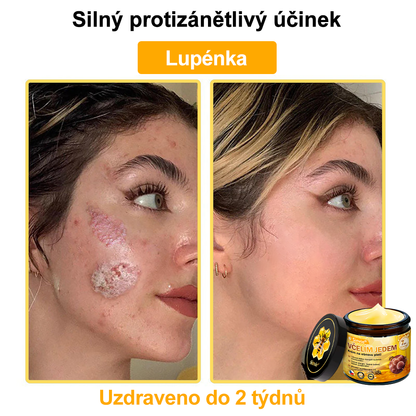 🎈🎈Sinvie® Krém na obnovu pleti s včelím jedem | 50 ml | Doporučeno Českou dermatovenerologickou společností