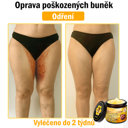 🎈Sinvie® Krém na obnovu pleti s včelím jedem | 50 ml | Doporučeno Českou dermatovenerologickou společností