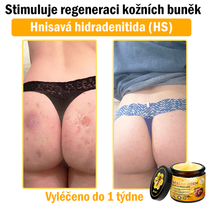 🎈Sinvie® Krém na obnovu pleti s včelím jedem | 50 ml | Doporučeno Českou dermatovenerologickou společností