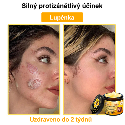 ⚡Sinvie® Krém na obnovu pleti s včelím jedem | 50 ml | Doporučeno Českou dermatovenerologickou společností
