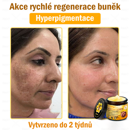 🌻 Sinvie® Krém na obnovu pleti s včelím jedem 🔥 Doporučeno dermatology | Proti vráskám, pigmentovým skvrnám a ochablé pleti - 50 ml