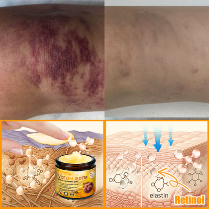 🌻 Sinvie® Krém na obnovu pleti s včelím jedem 🔥 Doporučeno dermatology | Proti vráskám, pigmentovým skvrnám a ochablé pleti - 50 ml